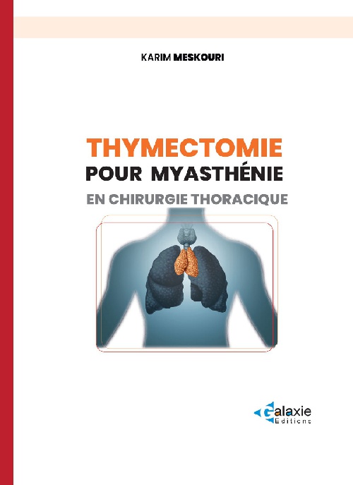 Thymectomie pour Myasthénie en Chirurgie ThoraciqueI