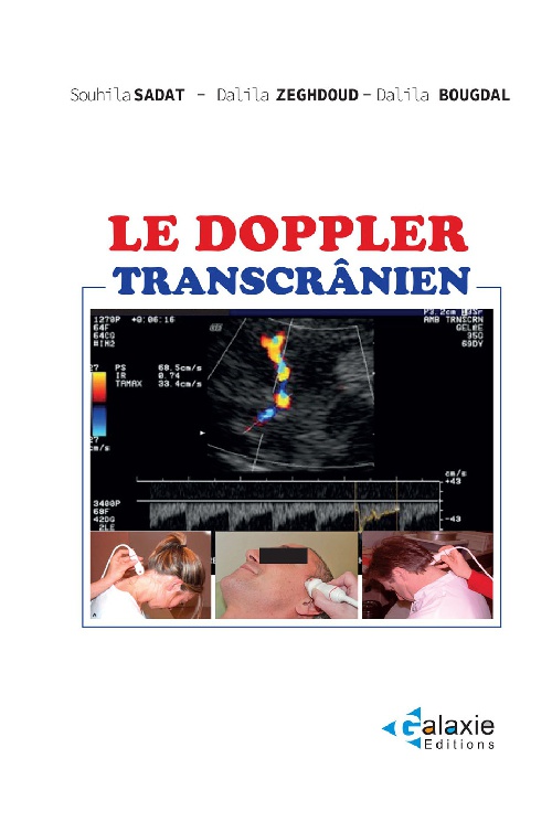 Le Doppler Transcrânier