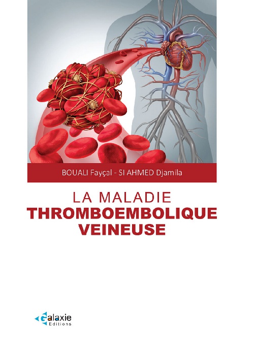 La Maladie THROMOEMBOLIQUE VEINEUSE