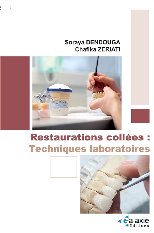 Restaurations Collées : Techniques Laboratoires