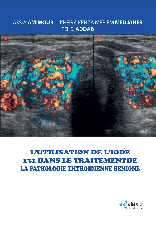 L'Utilisation de l'Iode 131 dans le traitement de la Pathologie Thyroïdienne Benigne