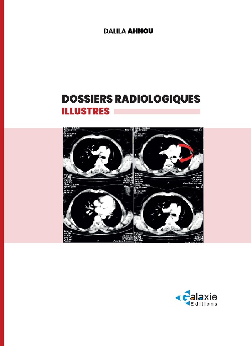 Dossiers Radiologiques Illustrés