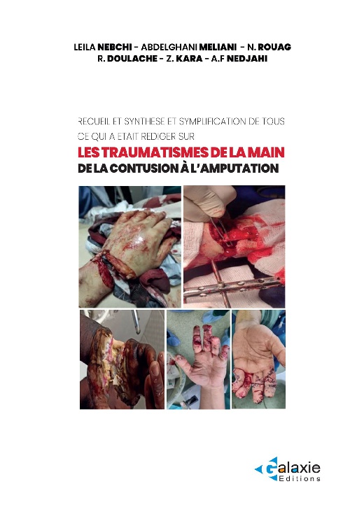 les traumatismes de la Main de la Contusion à l'Amputation